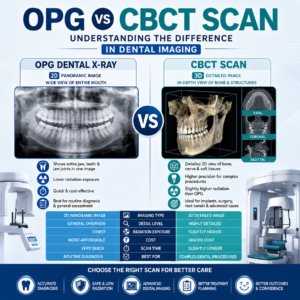 OPG vs CBCT scan