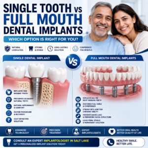 single tooth vs full mouth dental implants
